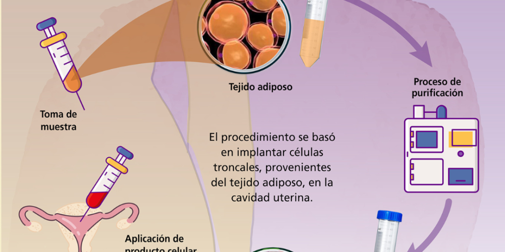 Reparación del endometrio con células madre: una esperanza para quienes buscan ser madres